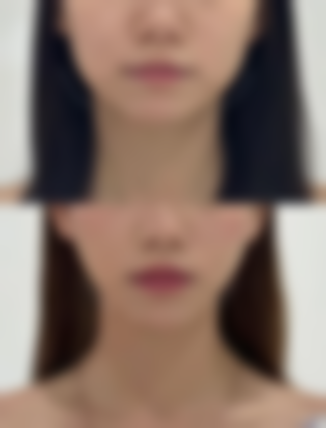 伊美芝皮肤科上班时间，地址在哪儿