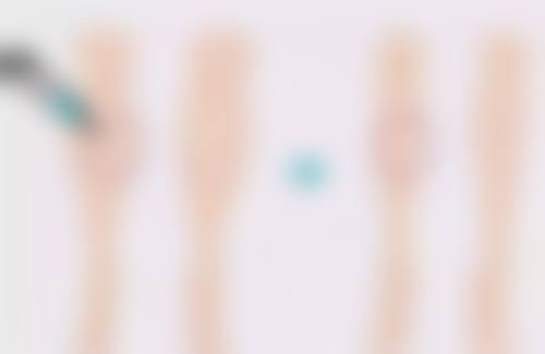 专精整形医院如何为你量身定制300cc方案