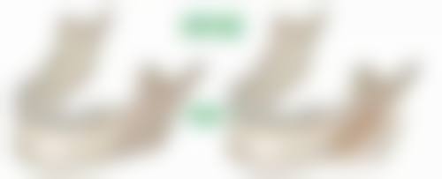 膨体硅胶隆鼻哪个好之安心性对决:医院标准衡量谁更“温柔体贴”?