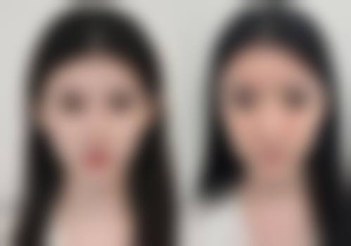 上海伦新医疗美容门诊部顾客实例有哪些