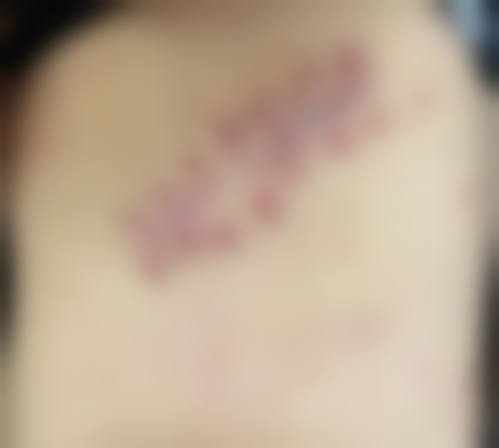 八、秦皇岛友谊医院整形美容外科怎么样价格表