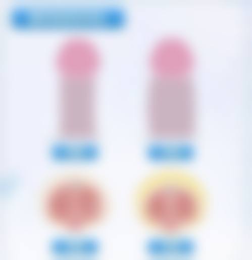 眼部有眼袋同黑色素怎样去掉——食疗内调：吃出来的美丽双眸