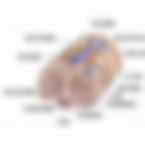 找到属于你的“亮眼方案”