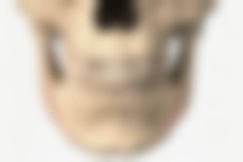 割双眼皮有痕迹修复之疤痕隐形术费用揭秘