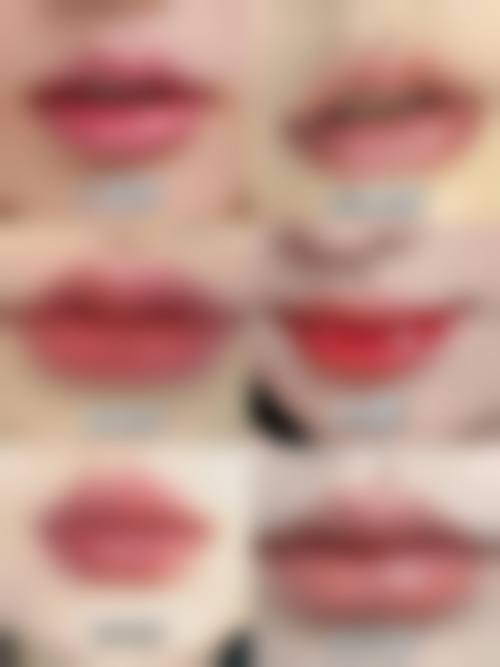 梅州皇佳贝丽整形医院项目特色