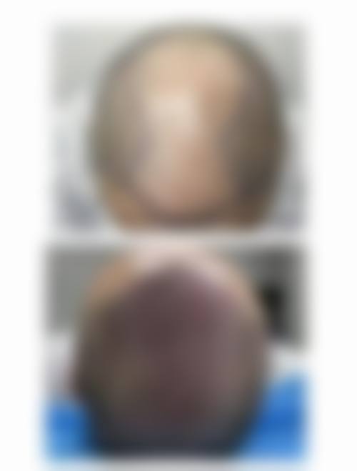 昆明新新华医院毛发种植中 心基本信息