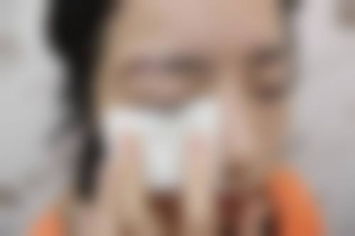 昆明新新华医院毛发种植中 心口碑评价