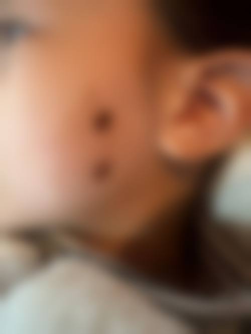 唐山慧惠医疗美容诊所更擅长什么手术