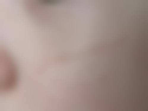 南通英莎医疗美容门诊部李辉实例成效——科姿诺医疗美容诊所剖析