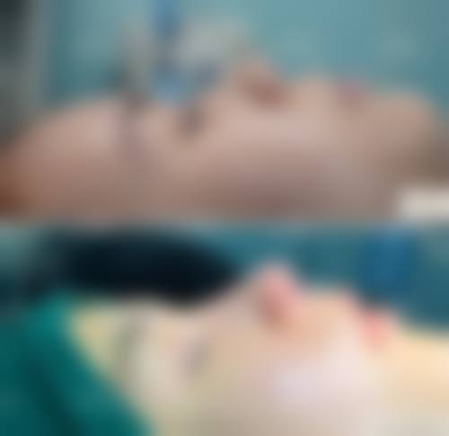 福州新世纪整形医院价格表