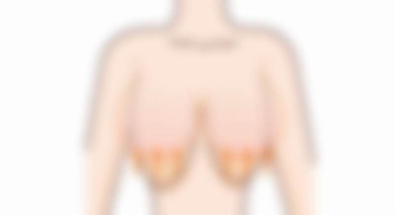 广州高尚医学美容中 心李翠华做的手术怎么样——解决黑眼圈和眼袋问题解析