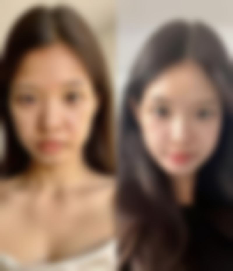 南京小氧甄妮整形医院项目特色