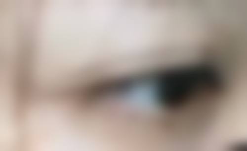 韩国MIGO整形外科医院价格表