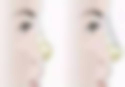 李喜文医生简介做手术价格