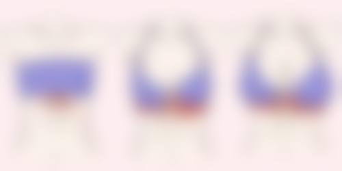 疾病引发眼袋出现的原因怎么消除