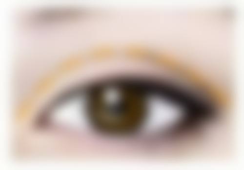 其他影响因素:割双眼皮肉条形成的“配角登场”