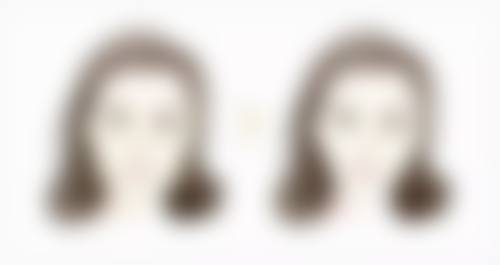 李喜文医生简介项目优势