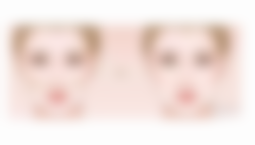 疤痕体质熬夜:免疫力下降让疤痕“雪上加霜”