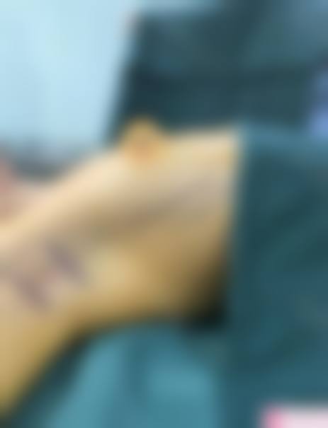 玉林市卫生学校附属医院口碑好不好?附真实患者口碑评价