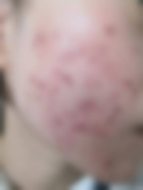 武汉媄妲医疗美容抖音团购活动及价格表