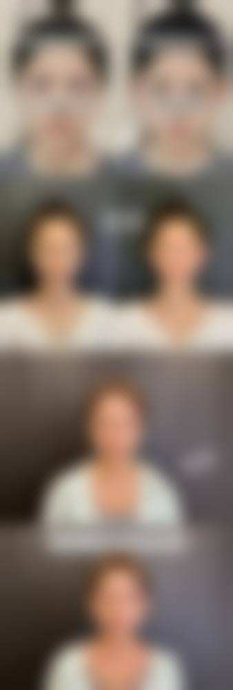 东莞知美整形医院价格表