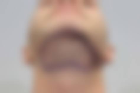 长沙长海植发科怎么样？口碑情况