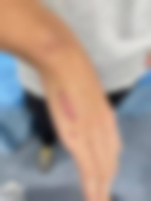 东莞知美整形医院口碑好不好？附真实患者口碑评价