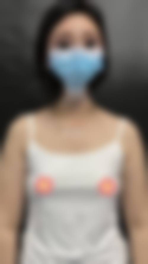 李贺楠医生做手术价格