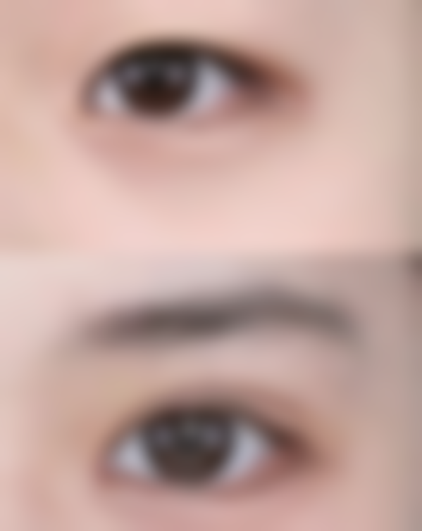 怎样祛除眼袋泪沟，手术+按摩+眼霜三管齐下告别憔悴眼