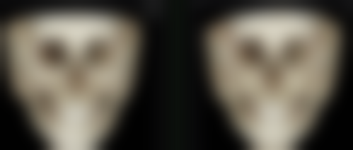 腿部抽脂医院选择与局部麻木危害