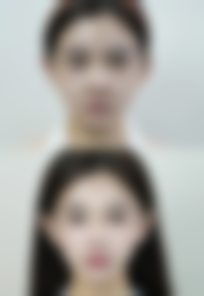 怎样祛除眼袋泪沟:日常生活小贴士——良好习惯预防眼袋泪沟