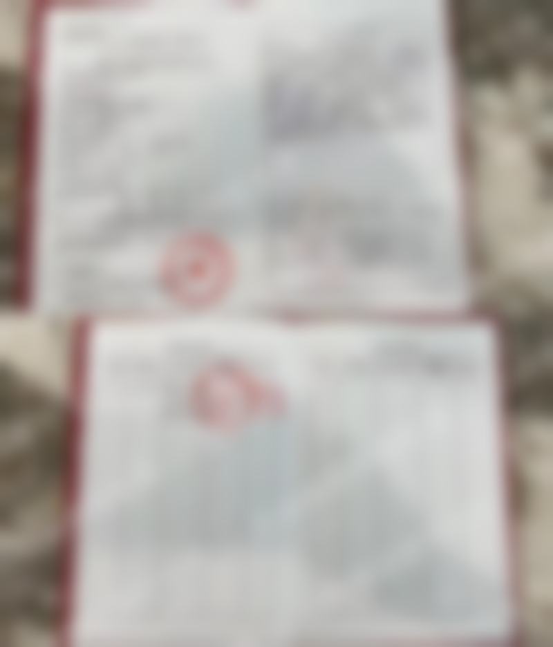 沈阳北方整形【中下面部吸脂 双下巴+面颊+下颌缘+口角囊袋+30000】项目顾客实例成效