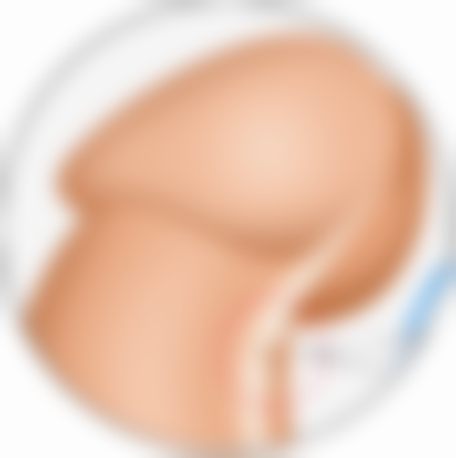 线提升隆鼻可吸收线材质及吸收时间分析