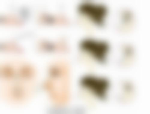 曼托假体做隆胸之适合人群一览