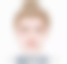 年龄增长对疤痕体质随着年龄多方面影响