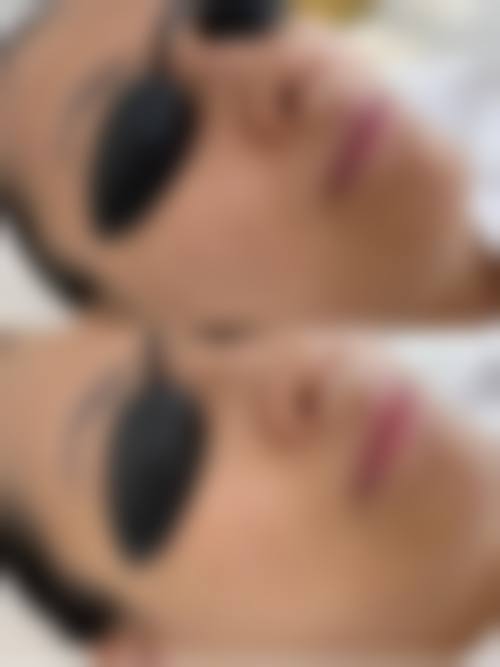 龙岩莱恩整形外科门诊部顾客实例