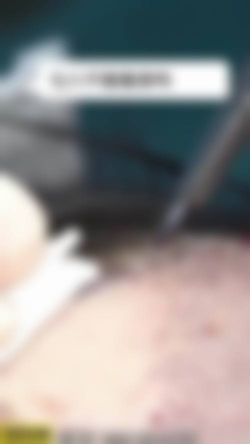 七、广州新发现植发医院真实患者口碑评价:良好口碑的有力证明