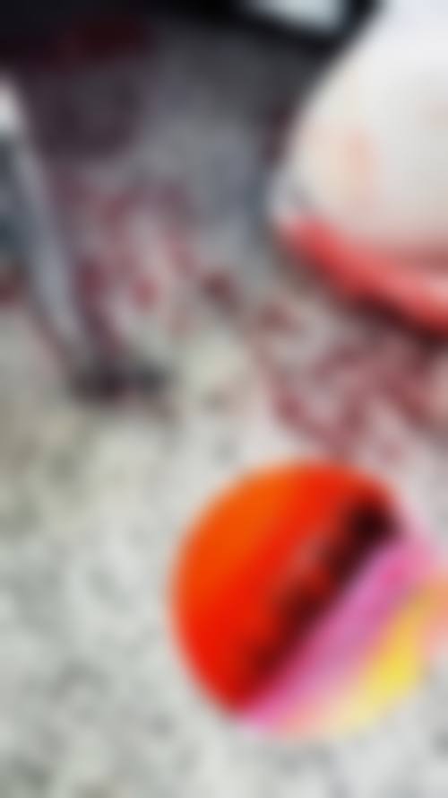 四、广州新发现植发医院项目特色:多样特色项目满足需求