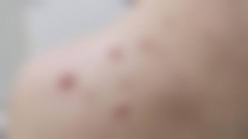 八、南华大学附属第一医院烧伤整形外科价格表