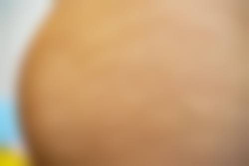 绵阳市中 心医院(烧伤整形外科)项目特色