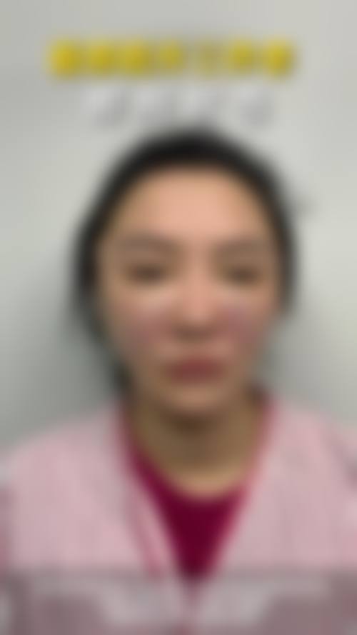 广州中山医博济整形美容医院怎么样之真实患者口碑评价