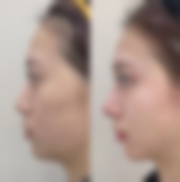 蚌埠多妍整形医院价格表怎么样