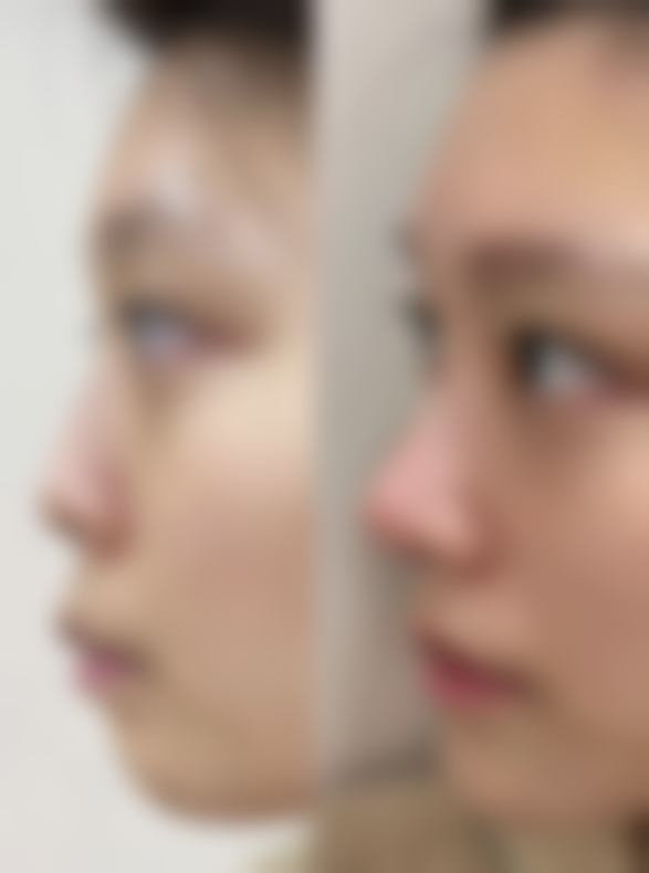 昆明市西山区金蔷薇医疗美容诊所价格表