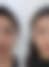 PichetRodchareon医生简介项目优势