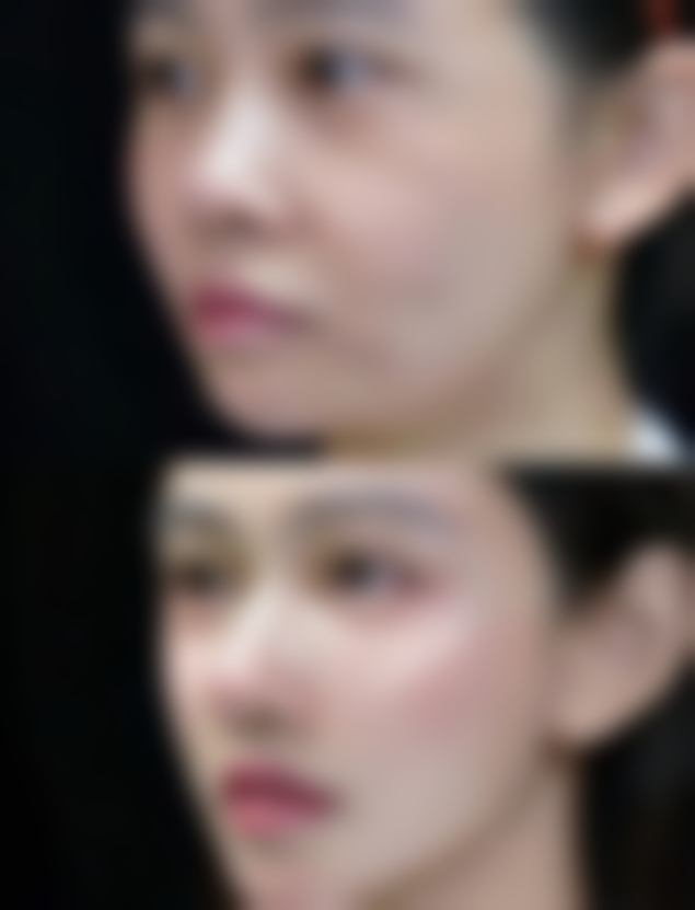 手术后的精心护理与修复：迈向健康新起点