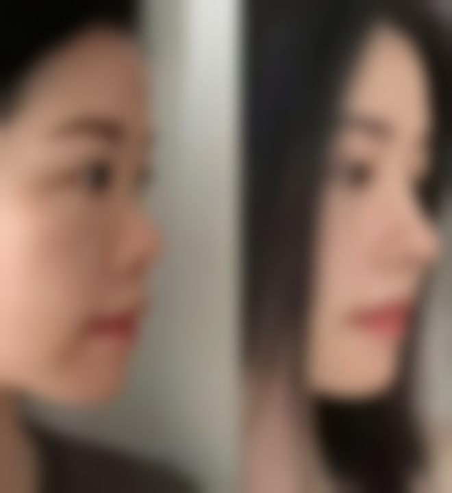 韩国德希尔皮肤科抖音团购活动及价格表