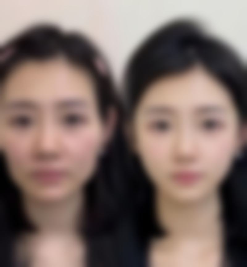 叶根生医生简介中的项目优势