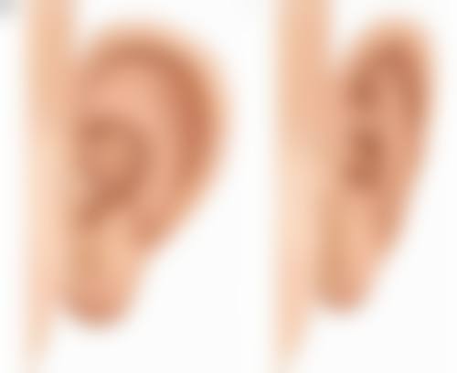 切除眼袋的疤痕多久才能好?长期护理的贴心建议