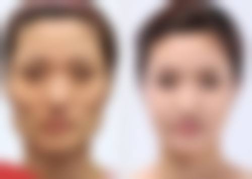 祛疤需要耐心与科学方法并重