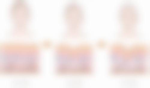 祛痣增生疤痕怎么才能去除之美容机构专精护